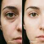 Parches de microinfusión